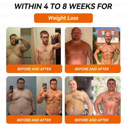 𝐷𝑖𝑎𝑝𝑎𝑠𝑜𝑛®🙇🏿‍♀️ 𝑁𝐴𝐷+ 𝐺𝐿𝑃-1 𝑆𝑙𝑖𝑚𝑚𝑖𝑛𝑔 𝐷𝑟𝑜𝑝𝑠 - 𝑆𝑢𝑖𝑡𝑎𝑏𝑙𝑒 𝑓𝑜𝑟 𝑜𝑏𝑒𝑠𝑖𝑡𝑦, 𝑑𝑖𝑎𝑏𝑒𝑡𝑒𝑠, 𝑐𝑎𝑟𝑑𝑖𝑜𝑣𝑎𝑠𝑐𝑢𝑙𝑎𝑟 𝑑𝑖𝑠𝑒𝑎𝑠𝑒𝑠