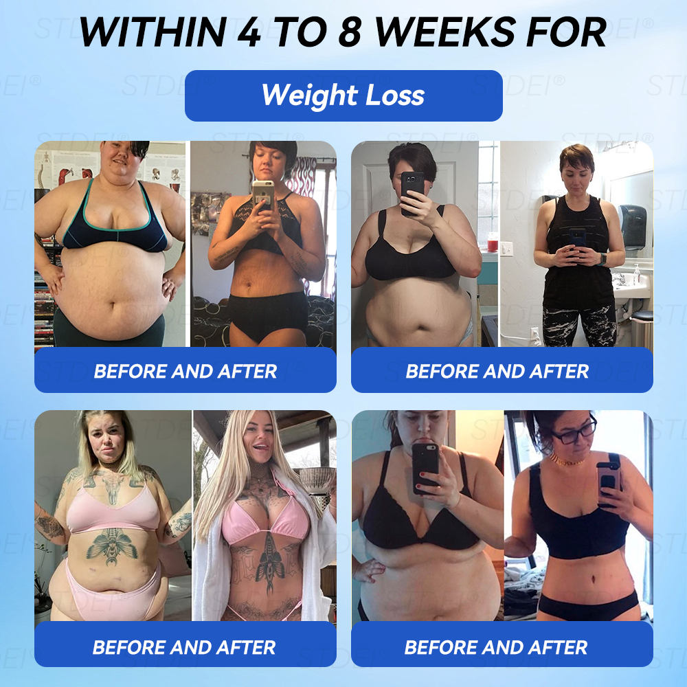 【𝑂𝑓𝑓𝑖𝑐𝑖𝑎𝑙 𝑆𝑡𝑜𝑟𝑒 】𝑆𝑇𝐷𝐸𝐼® 𝐺𝐿𝑃-1 𝑆𝑙𝑖𝑚𝑚𝑖𝑛𝑔 & 𝐻𝑒𝑎𝑙𝑡ℎ𝑦 𝐴𝑚𝑝𝑜𝑢𝑙𝑒 𝑂𝑟𝑎𝑙 𝐿𝑖𝑞𝑢𝑖𝑑 - 👨‍⚕️ 𝑂𝑏𝑒𝑠𝑖𝑡𝑦,𝐶𝑎𝑟𝑑𝑖𝑜𝑣𝑎𝑠𝑐𝑢𝑙𝑎𝑟 𝐷𝑖𝑠𝑒𝑎𝑠, 𝐷𝑖𝑎𝑏𝑒𝑡𝑒𝑠, 𝑆𝑙𝑒𝑒𝑝 𝐴𝑝𝑛𝑒𝑎