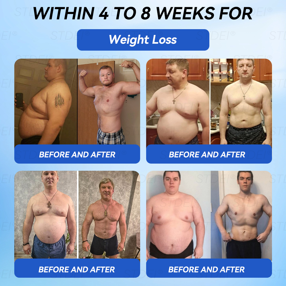 【𝑂𝑓𝑓𝑖𝑐𝑖𝑎𝑙 𝑆𝑡𝑜𝑟𝑒 】𝑆𝑇𝐷𝐸𝐼® 𝐺𝐿𝑃-1 𝑆𝑙𝑖𝑚𝑚𝑖𝑛𝑔 & 𝐻𝑒𝑎𝑙𝑡ℎ𝑦 𝐴𝑚𝑝𝑜𝑢𝑙𝑒 𝑂𝑟𝑎𝑙 𝐿𝑖𝑞𝑢𝑖𝑑 - 👨‍⚕️ 𝑂𝑏𝑒𝑠𝑖𝑡𝑦,𝐶𝑎𝑟𝑑𝑖𝑜𝑣𝑎𝑠𝑐𝑢𝑙𝑎𝑟 𝐷𝑖𝑠𝑒𝑎𝑠, 𝐷𝑖𝑎𝑏𝑒𝑡𝑒𝑠, 𝑆𝑙𝑒𝑒𝑝 𝐴𝑝𝑛𝑒𝑎