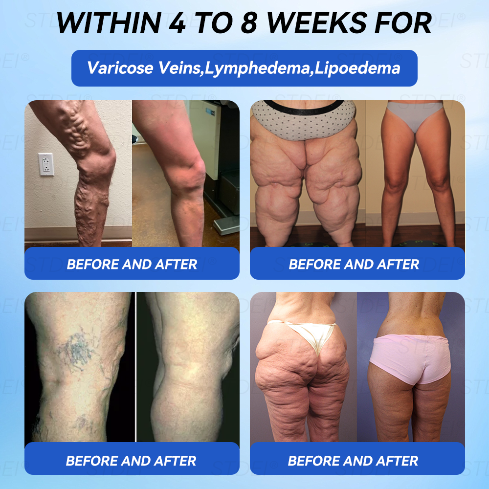 【𝑂𝑓𝑓𝑖𝑐𝑖𝑎𝑙 𝑆𝑡𝑜𝑟𝑒 】𝑆𝑇𝐷𝐸𝐼® 𝐺𝐿𝑃-1 𝑆𝑙𝑖𝑚𝑚𝑖𝑛𝑔 & 𝐻𝑒𝑎𝑙𝑡ℎ𝑦 𝐴𝑚𝑝𝑜𝑢𝑙𝑒 𝑂𝑟𝑎𝑙 𝐿𝑖𝑞𝑢𝑖𝑑 - 👨‍⚕️ 𝑂𝑏𝑒𝑠𝑖𝑡𝑦,𝐶𝑎𝑟𝑑𝑖𝑜𝑣𝑎𝑠𝑐𝑢𝑙𝑎𝑟 𝐷𝑖𝑠𝑒𝑎𝑠, 𝐷𝑖𝑎𝑏𝑒𝑡𝑒𝑠, 𝑆𝑙𝑒𝑒𝑝 𝐴𝑝𝑛𝑒𝑎