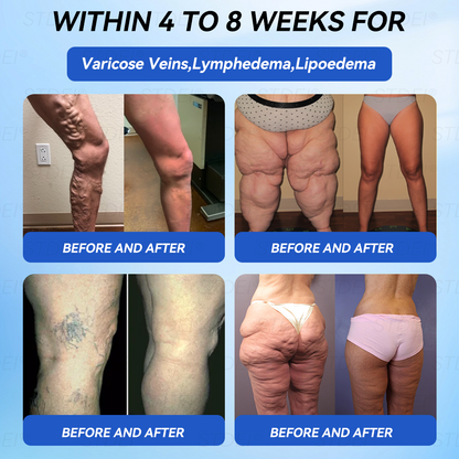 【𝑂𝑓𝑓𝑖𝑐𝑖𝑎𝑙 𝑆𝑡𝑜𝑟𝑒 】𝑆𝑇𝐷𝐸𝐼® 𝐺𝐿𝑃-1 𝑆𝑙𝑖𝑚𝑚𝑖𝑛𝑔 & 𝐻𝑒𝑎𝑙𝑡ℎ𝑦 𝐴𝑚𝑝𝑜𝑢𝑙𝑒 𝑂𝑟𝑎𝑙 𝐿𝑖𝑞𝑢𝑖𝑑 - 👨‍⚕️ 𝑂𝑏𝑒𝑠𝑖𝑡𝑦,𝐶𝑎𝑟𝑑𝑖𝑜𝑣𝑎𝑠𝑐𝑢𝑙𝑎𝑟 𝐷𝑖𝑠𝑒𝑎𝑠, 𝐷𝑖𝑎𝑏𝑒𝑡𝑒𝑠, 𝑆𝑙𝑒𝑒𝑝 𝐴𝑝𝑛𝑒𝑎