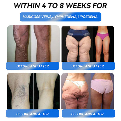 IFMAGIC® 💧 GLP-1 Pro Weight Loss Oral Solution  One dose a day — see results in 7 days Suitable for obesity, cardiovascular diseases, diabetes, sleep apnea, high cholesterol and blood lipids, joint problems, and various other conditions