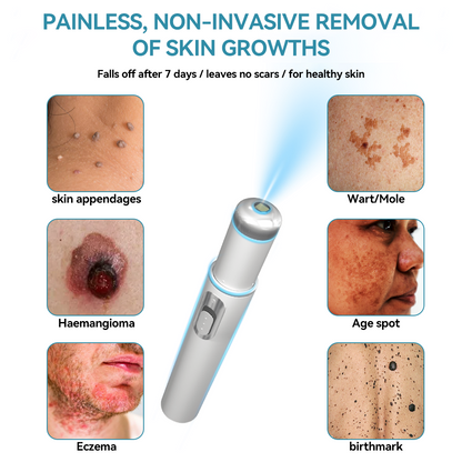 [Visible results in just 7 days]💧𝐉𝐚𝐬𝐬𝐞𝐞𝐦® Non-invasive Mole and Wart Removal Laser Pen (Quick and painless removal of warts, moles, age spots and skin tags - without any side effects)🫐