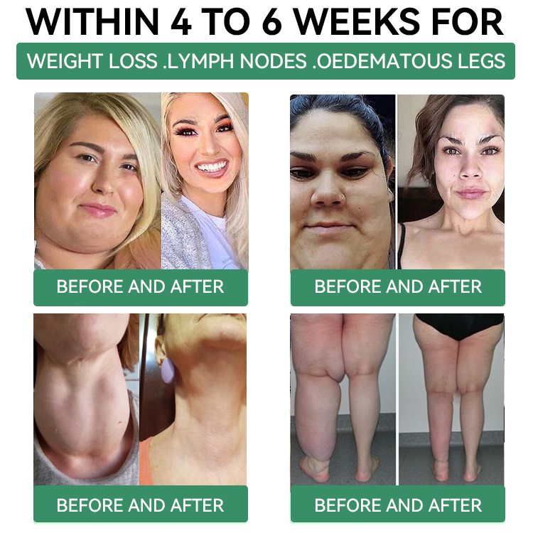 [𝑂𝑓𝑓𝑖𝑐𝑖𝑎𝑙 𝑆𝑡𝑜𝑟𝑒] 🎁🎁𝐶𝑍𝑇𝐼𝐶𝐿𝐸® 𝐺𝐿𝑃-1  𝑆𝑙𝑖𝑚𝑚𝑖𝑛𝑔 & 𝐻𝑒𝑎𝑙𝑡ℎ 𝑁𝑎𝑠𝑎𝑙 𝑅𝑖𝑛𝑔 ｜⚡ 𝐹𝑎𝑠𝑡 𝐹𝑎𝑡 𝐵𝑢𝑟𝑛 & 𝑀𝑒𝑡𝑎𝑏𝑜𝑙𝑖𝑐 𝐵𝑎𝑙𝑎𝑛𝑐𝑒