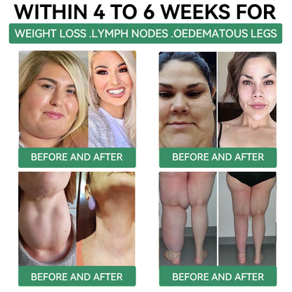 [𝑂𝑓𝑓𝑖𝑐𝑖𝑎𝑙 𝑆𝑡𝑜𝑟𝑒] 🎁🎁𝐶𝑍𝑇𝐼𝐶𝐿𝐸® 𝐺𝐿𝑃-1  𝑆𝑙𝑖𝑚𝑚𝑖𝑛𝑔 & 𝐻𝑒𝑎𝑙𝑡ℎ 𝑁𝑎𝑠𝑎𝑙 𝑅𝑖𝑛𝑔 ｜⚡ 𝐹𝑎𝑠𝑡 𝐹𝑎𝑡 𝐵𝑢𝑟𝑛 & 𝑀𝑒𝑡𝑎𝑏𝑜𝑙𝑖𝑐 𝐵𝑎𝑙𝑎𝑛𝑐𝑒