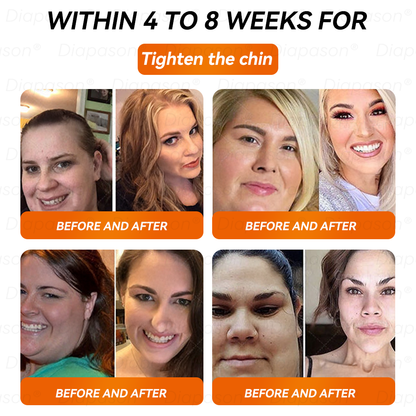 𝐷𝑖𝑎𝑝𝑎𝑠𝑜𝑛®🙇🏿‍♀️ 𝑁𝐴𝐷+ 𝐺𝐿𝑃-1 𝑆𝑙𝑖𝑚𝑚𝑖𝑛𝑔 𝐷𝑟𝑜𝑝𝑠 - 𝑆𝑢𝑖𝑡𝑎𝑏𝑙𝑒 𝑓𝑜𝑟 𝑜𝑏𝑒𝑠𝑖𝑡𝑦, 𝑑𝑖𝑎𝑏𝑒𝑡𝑒𝑠, 𝑐𝑎𝑟𝑑𝑖𝑜𝑣𝑎𝑠𝑐𝑢𝑙𝑎𝑟 𝑑𝑖𝑠𝑒𝑎𝑠𝑒𝑠