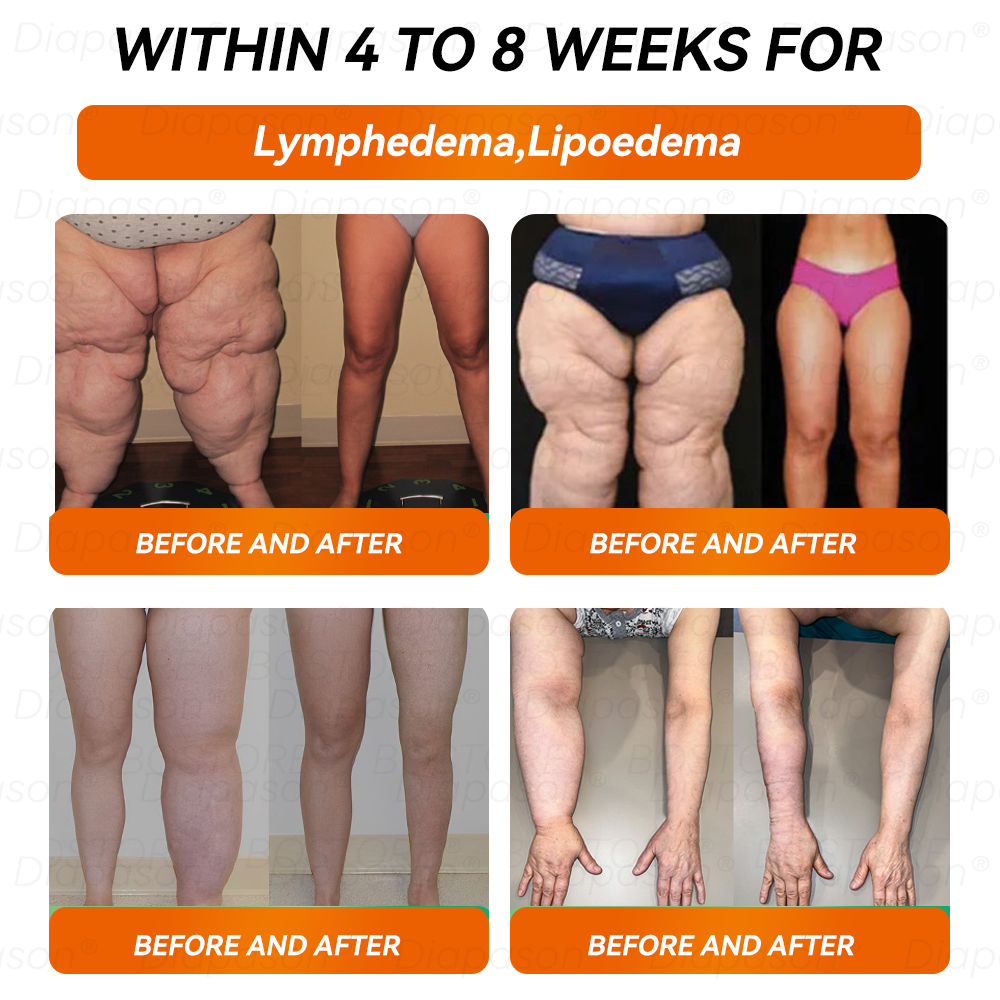 𝐷𝑖𝑎𝑝𝑎𝑠𝑜𝑛®🙇🏿‍♀️ 𝑁𝐴𝐷+ 𝐺𝐿𝑃-1 𝑆𝑙𝑖𝑚𝑚𝑖𝑛𝑔 𝐷𝑟𝑜𝑝𝑠 - 𝑆𝑢𝑖𝑡𝑎𝑏𝑙𝑒 𝑓𝑜𝑟 𝑜𝑏𝑒𝑠𝑖𝑡𝑦, 𝑑𝑖𝑎𝑏𝑒𝑡𝑒𝑠, 𝑐𝑎𝑟𝑑𝑖𝑜𝑣𝑎𝑠𝑐𝑢𝑙𝑎𝑟 𝑑𝑖𝑠𝑒𝑎𝑠𝑒𝑠