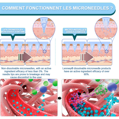 【𝗟𝗮𝘀𝘁 𝗗𝗮𝘆 𝗣𝗿𝗼𝗺𝗼𝘁𝗶𝗼𝗻 𝟲𝟬% 𝗢𝗙𝗙✨】 𝗟𝗲𝗻𝗿𝗲𝗲𝘆® 𝗡𝗜𝗗𝗗𝗞-𝗧𝗶𝗿𝘇𝗲𝗽𝗮𝘁𝗶𝗱𝗲 𝗦𝗹𝗶𝗺𝗺𝗶𝗻𝗴 & 𝗛𝗲𝗮𝗹𝘁𝗵 𝗡𝗔𝗡𝗢 𝗠𝗜𝗖𝗥𝗢𝗡𝗘𝗘𝗗𝗟𝗘 𝗣𝗔𝗧𝗖𝗛 (𝗭𝗲𝗿𝗼 𝗣𝗮𝗶𝗻, 𝟮𝟰/𝟳 𝗥𝗲𝗹𝗲𝗮𝘀𝗲 | 𝗟𝗼𝘀𝗲 𝟮𝟬𝗹𝗯𝘀 𝗙𝗔𝗦𝗧 | 💝𝗧𝗶𝗴𝗵𝘁𝗲𝗻𝘀 𝗟𝗼𝗼𝘀𝗲 𝗦𝗸𝗶𝗻 | 𝟵𝟬% 𝗦𝘂𝗴𝗮𝗿 𝗗𝗿𝗼𝗽)🍁💖