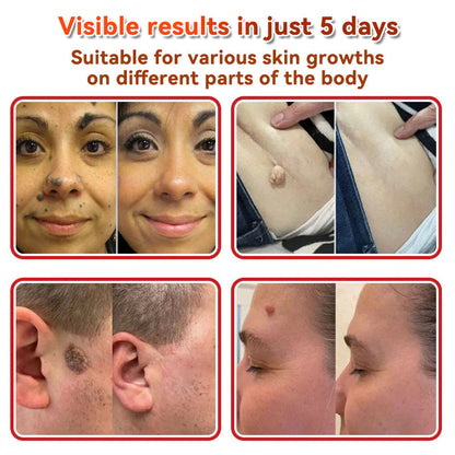 𝐅𝐀𝐓𝐎𝐍𝐆® 𝐌𝐢𝐜𝐫𝐨𝐍𝐞𝐞𝐝𝐥𝐞 𝐁𝐨𝐭𝐚𝐧𝐢𝐜 𝐒𝐤𝐢𝐧 𝐓𝐚𝐠 𝐑𝐞𝐦𝐨𝐯𝐚𝐥 𝐏𝐚𝐭𝐜𝐡 - Made in the U.K 🍁💖