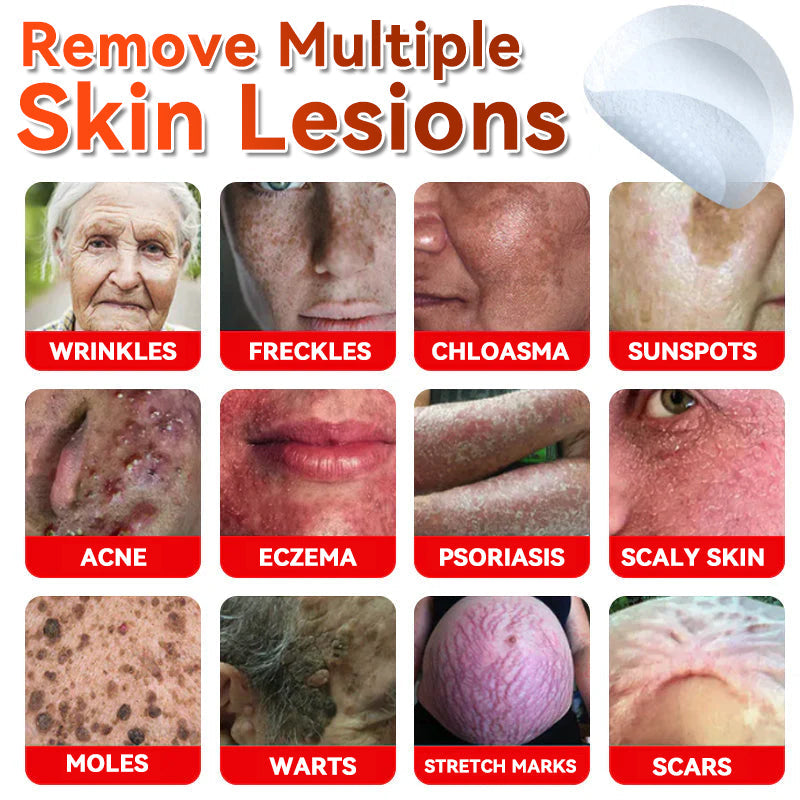 𝐅𝐀𝐓𝐎𝐍𝐆® 𝐌𝐢𝐜𝐫𝐨𝐍𝐞𝐞𝐝𝐥𝐞 𝐁𝐨𝐭𝐚𝐧𝐢𝐜 𝐒𝐤𝐢𝐧 𝐓𝐚𝐠 𝐑𝐞𝐦𝐨𝐯𝐚𝐥 𝐏𝐚𝐭𝐜𝐡 - Made in the U.K 🍁💖