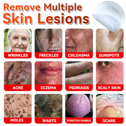 𝐅𝐀𝐓𝐎𝐍𝐆® 𝐌𝐢𝐜𝐫𝐨𝐍𝐞𝐞𝐝𝐥𝐞 𝐁𝐨𝐭𝐚𝐧𝐢𝐜 𝐒𝐤𝐢𝐧 𝐓𝐚𝐠 𝐑𝐞𝐦𝐨𝐯𝐚𝐥 𝐏𝐚𝐭𝐜𝐡 - Made in the U.K 🍁💖